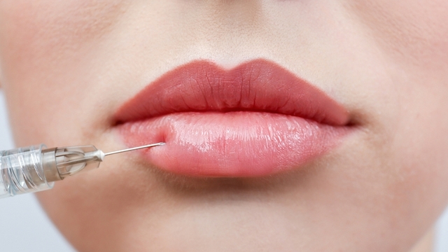 Is It Safe to Get Lip Fillers in Dubai?