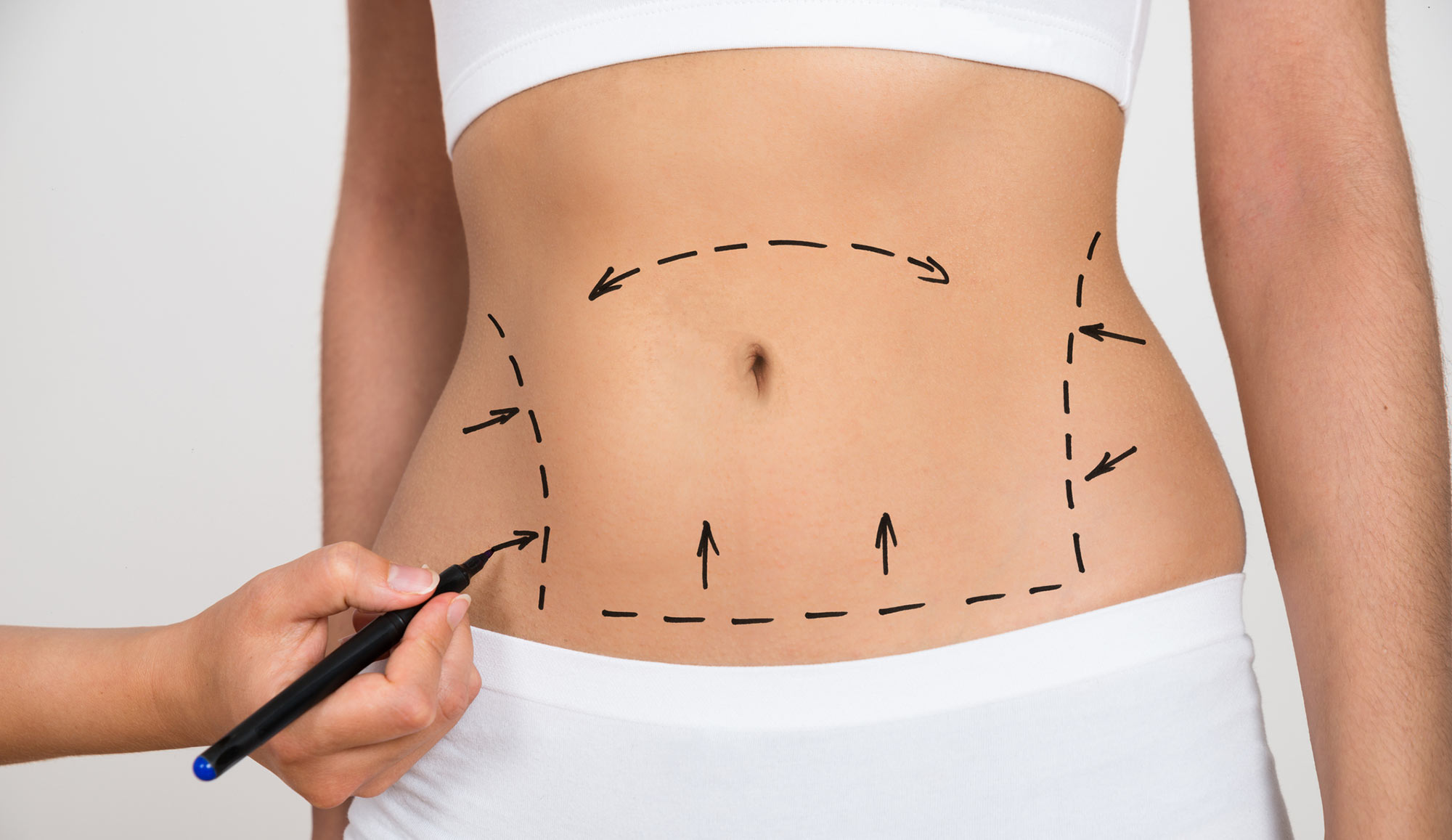 Why Tummy Tuck in Dubai Is Gaining Popularity
