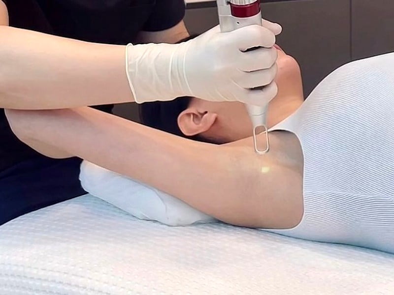 Safe Underarm Whitening Treatments in Dubai