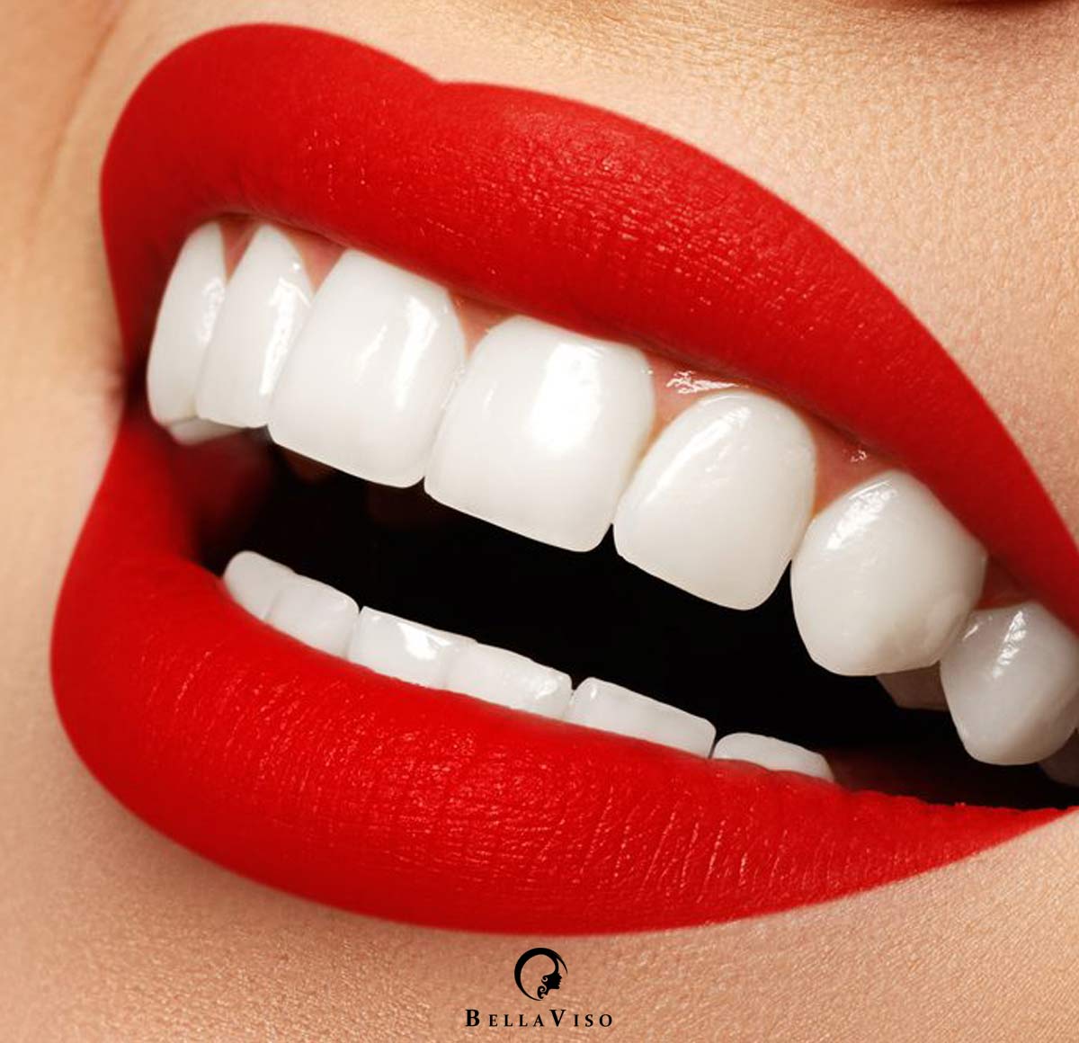 Transform Your Smile with Dental Veneers Treatment in Dubai UAE